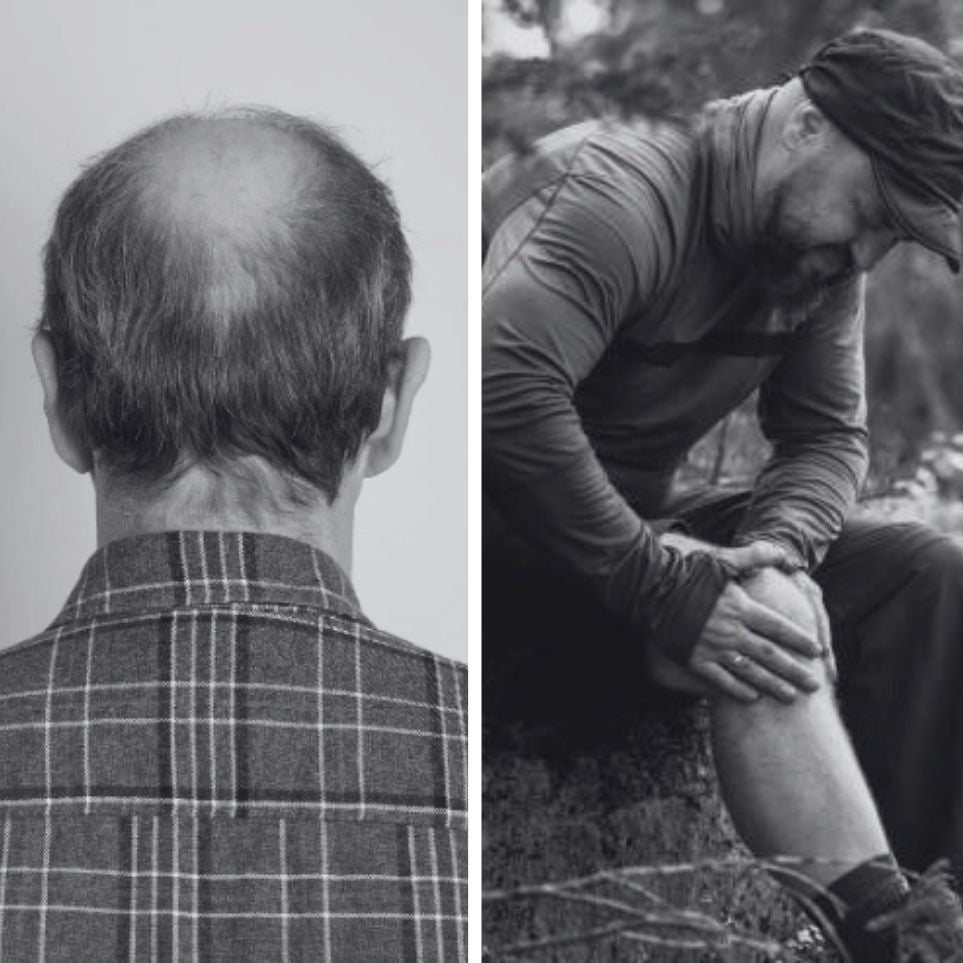 Two-panel photo: left — rear view of an older balding man in a plaid shirt; right — seated man outdoors clutching his knee, wearing a cap.